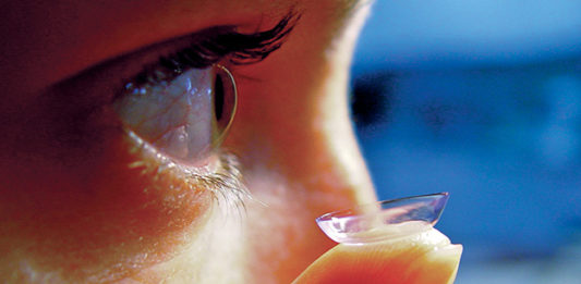 Tecnica LASIK o impiego di lenti a contatto: il giudizio dei pazienti