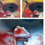 visualizzazione-iTrack-250A