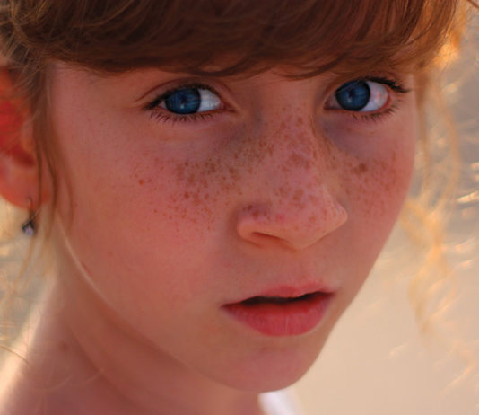 congiuntiviti allergiche