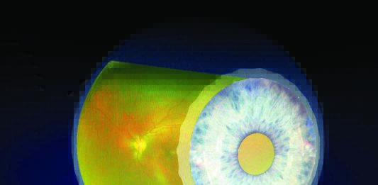 Retina artificiale