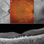 infrared-reflectance