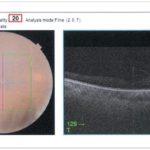 eye_doctor_2020_02.indd