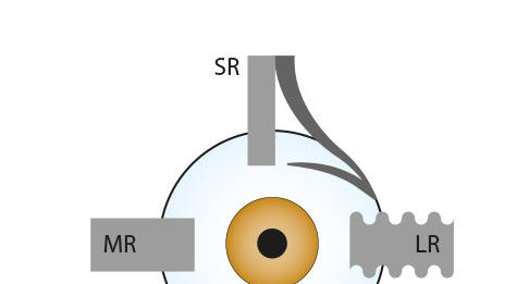 Fig. 1 Tecnica di Nishida.