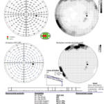 Fig. 2b esame del campo visivo
