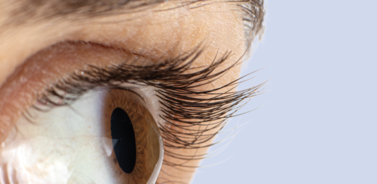 Epidemiologia del cheratocono