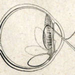 chirurgia-della-cataratta