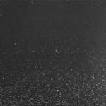 Biometria OCT che evidenzia reattività in CA, vaulting della lente fachica e vitreo limpido.