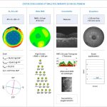 Fig. 10 Nei box azzurri sono riportati i criteri di inclusione ottimali per l’impianto di una IOL premium. Le immagini raffigurano invece condizioni cliniche non ideali.