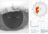 Fig. 1 N.I.B.U.T. Keratograph M5.