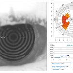 Fig. 1 N.I.B.U.T. Keratograph M5.