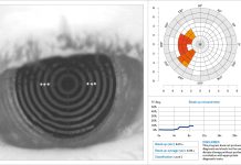 Fig. 1 N.I.B.U.T. Keratograph M5.