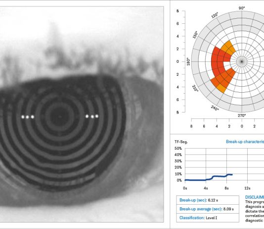 Fig. 1 N.I.B.U.T. Keratograph M5.