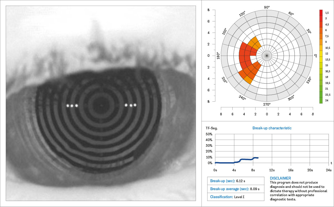Fig. 1 N.I.B.U.T. Keratograph M5.