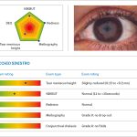 Fig. 1B Dry eye report ottenuto mediante l’utilizzo del Keratograph 5M (Oculus Optikgeräte GmbH, Wetzlar, Germania). Una combinazione di cinque parametri (altezza del menisco lacrimale, break-up time non invasivo, rossore congiuntivale, meibografia e congiuntivochalasi) viene visualizzata su un grafico radar a forma di pentagono.