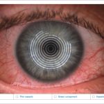 Fig. 4A Valutazione automatizzata della bulbar redness (arrossamento congiuntivale bulbare), eseguita con il Keratograph 5M (Oculus).