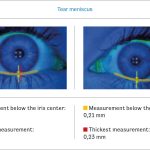 Fig. 6 THM con il Tear Check.