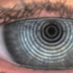 Fig. 8A-8C Tre diversi livelli dello strato lipico mediante Keratograph M5. 8A Livello 2: normale.