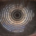 Fig. 8A-8C Tre diversi livelli dello strato lipico mediante Keratograph M5. 8B Livello 3: spesso.