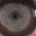 Fig. 8A-8C Tre diversi livelli dello strato lipico mediante Keratograph M5. 8C Livello 1: sottile.