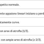 Fig. 9 Stadiazione meibografia mediante Keratograph.