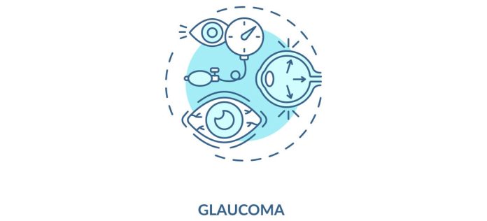 GLAUCOMA