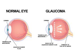 Brinzolamide e timololo: efficacia, tollerabilità e sicurezza nella gestione del glaucoma
