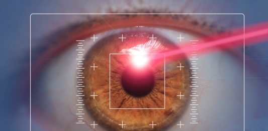 SMILE, LASIK e PRK: analisi comparativa dell’incidenza e severità dell’occhio secco postoperatorio