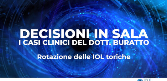 Rotazione delle IOL toriche