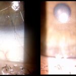 Gestione-visiva-e-metabolica