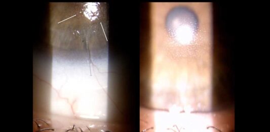 Gestione visiva e metabolica in condizioni estreme: case report di un pilota automobilistico professionista