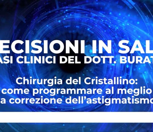 Chirurgia del cristallino: come programmare al meglio la correzione dell’astigmatismo