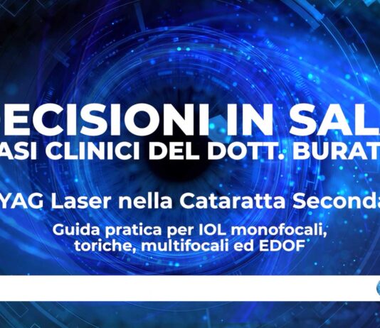 Nd:YAG Laser nella Cataratta Secondaria – Guida pratica per IOL monofocali, toriche, multifocali ed EDOF
