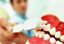 Erosione dentale: il consiglio del farmacista agli sportivi (e non solo) pulizia dentiera