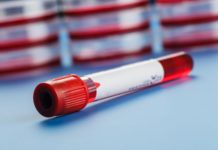 Talassemia: in mezzo tra paziente e patologia c’è (anche) la figura decisiva del farmacista