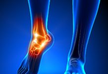 Il ruolo chiave della prevenzione e del farmacista nella lotta all’osteoporosi