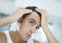 Problemi ai capelli: il consiglio della farmacia alopecia