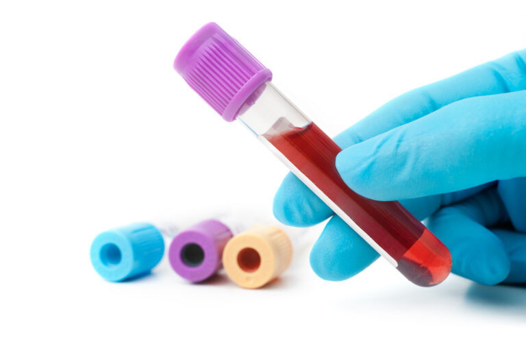 Mieloma multiplo, approvato isatuximab in combinazione con carfilzomib e desametasone