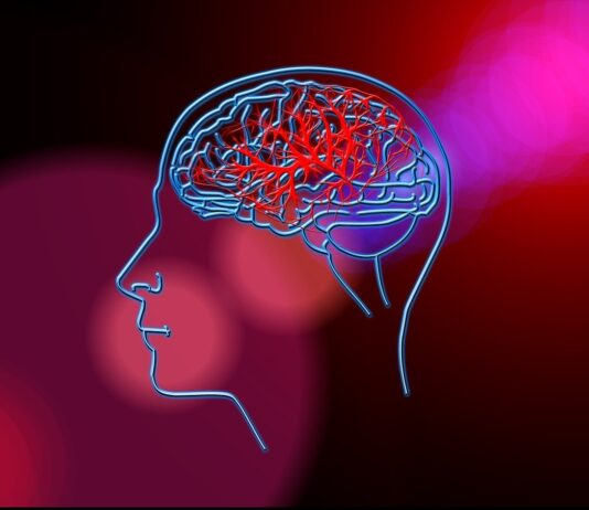 Ictus: cruciali gestione tempestiva e prevenzione, anche grazie alle farmacie