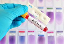 HIV-AIDS: necessario implementare test, cure e lotta allo stigma