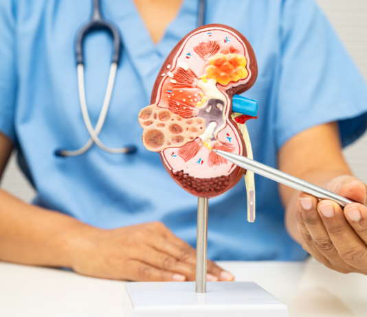 Giornata mondiale del tumore del rene, tra cambi di paradigma e efficacia del farmacista Giornata Mondiale del tumore del rene