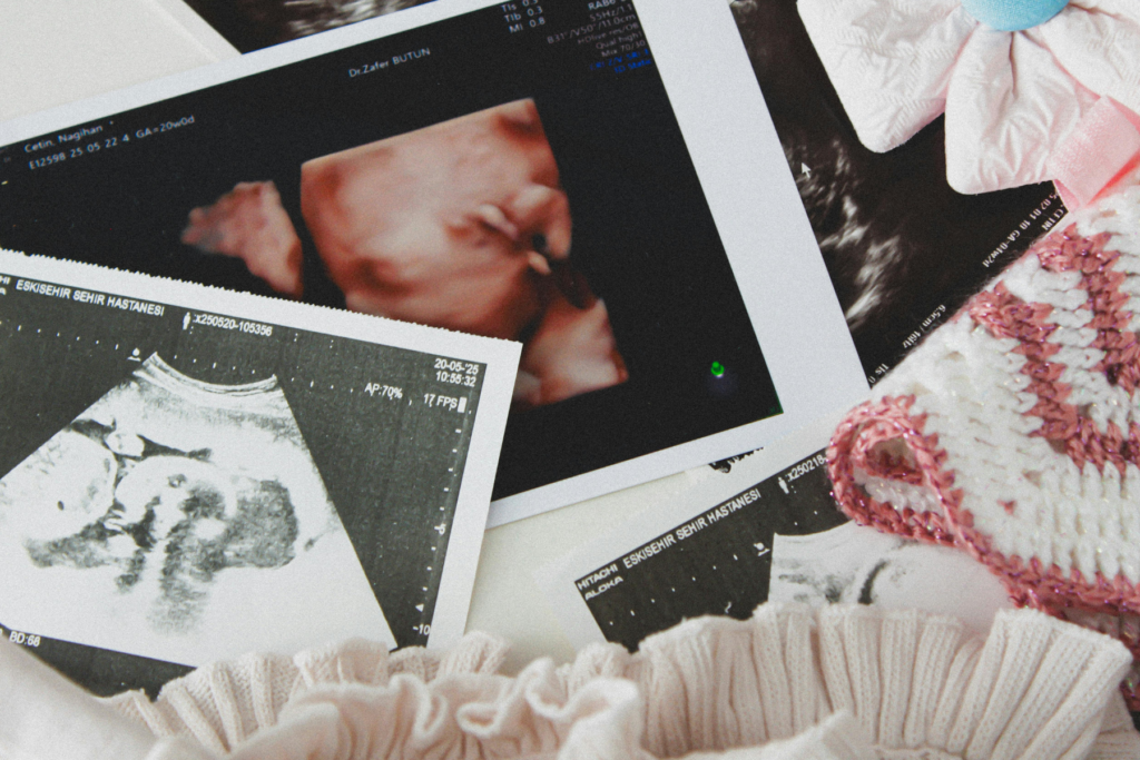 L'uso di paracetamolo in gravidanza non comporta alcun effetto neuroevolutivo