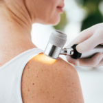 Euromelanoma Day, i giovani al centro della campagna di prevenzione 2026 EuromelanomaDay