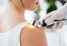 Euromelanoma Day, i giovani al centro della campagna di prevenzione 2026 EuromelanomaDay