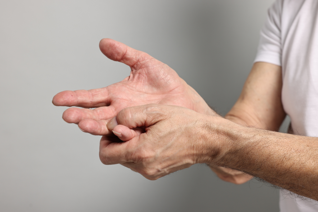 L'artrosi è più frequente negli uomini prima dei 40 anni, spesso a causa di traumi o deformità ossee