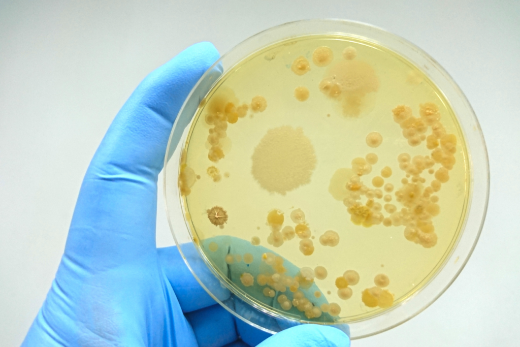 Il microbiota - ovvero l'insieme di batteri, funghi, protozoi e virus che convivono in armonia con l’organismo- trae nutrimento dall'alimentazione, variando la composizione in funzione dei cibi introiettati.