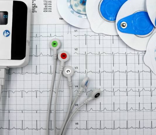 Telemedicina nel Lazio: al via Holter cardiaco e pressorio in convenzione con il SSN Telemedicina nel Lazio: al via Holter cardiaco e pressorio in convenzione con il SSN