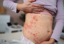 Vaccini in farmacia: un modello virtuoso che può ispirare anche nuove strategie contro il morbillo Vaccini in farmacia: il modello funziona, ma per l'allarme morbillo servono nuove strategie