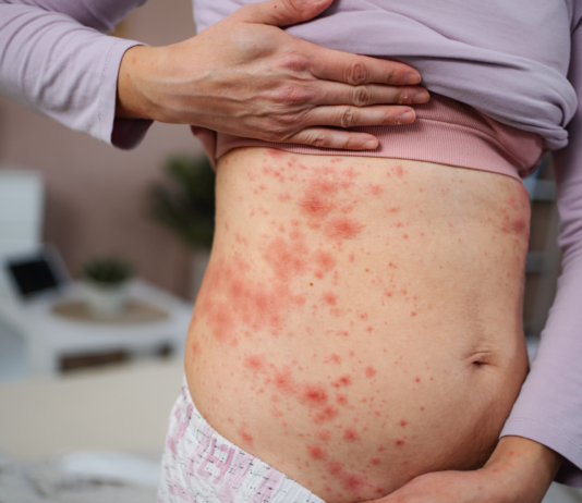 Vaccini in farmacia: un modello virtuoso che può ispirare anche nuove strategie contro il morbillo Vaccini in farmacia: il modello funziona, ma per l'allarme morbillo servono nuove strategie