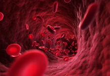 San Matteo di Pavia: arriva la terapia genica Casgevy