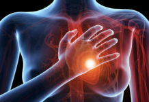 Infarto, gel iniettabile potrebbe riparare i danni